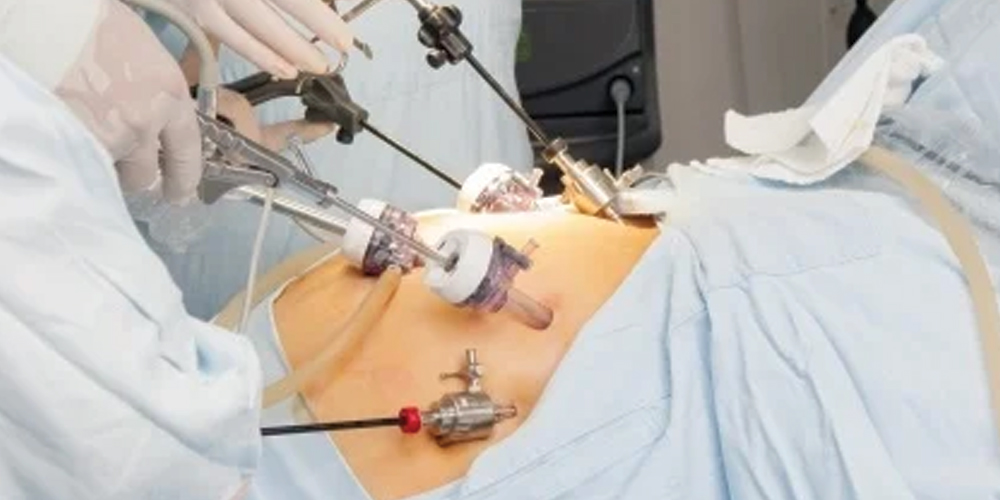 robotic laparoscopic hysterectomy procedure